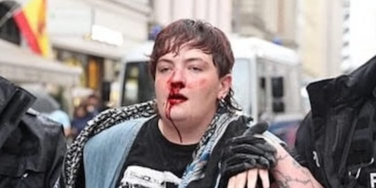 آزادی بیان به سبک آلمانی ؛ تشدید حمایت فلسطین و برخورد خشونت آمیز پلیس